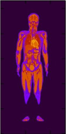 Human body epsilon