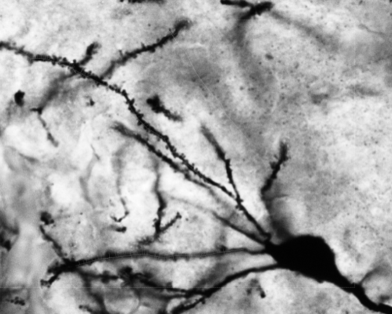 Golgi
