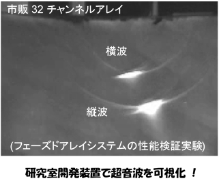 目からうろこの超音波